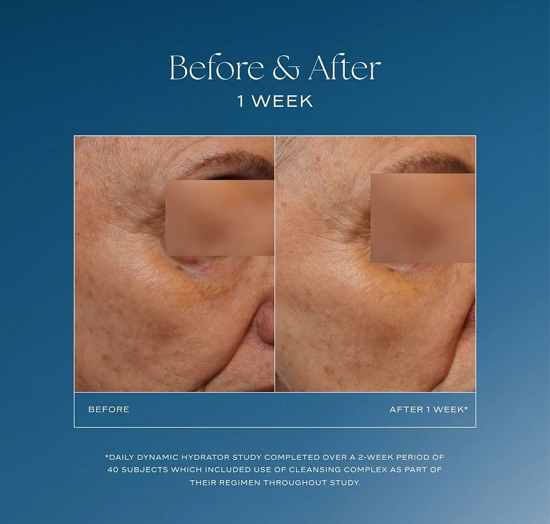 Is Clinical Daily Dynamic Hydrator 50ml.Ενυδατική κρέμα ημέρας με εξωσώματα.