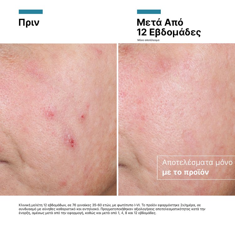 SkinCeuticals Advanced RGN-6 50ml.Κρέμα Ανάπλασης & Αντιγήρανσης.